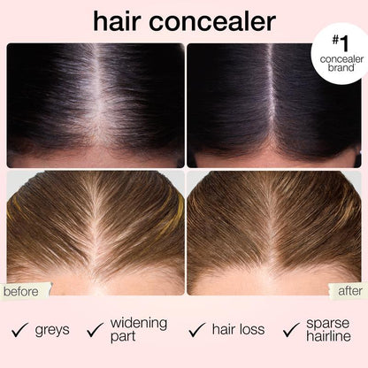 🔥LAST DAY: BUY 1 GET 1 FREE🌸Dab & go hair concealer